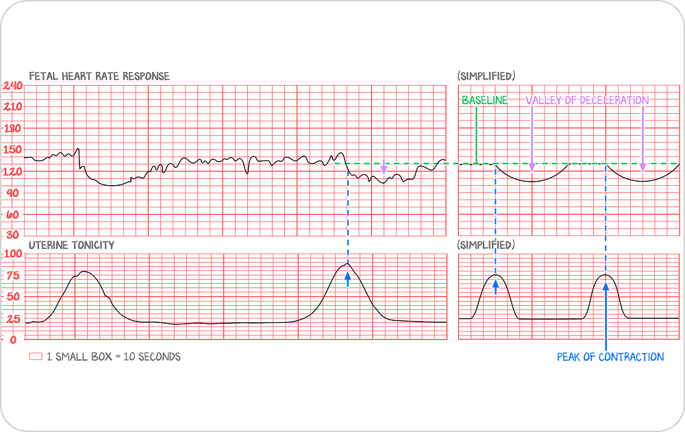 PANCE / PANRE exam preparation — physician assistant
