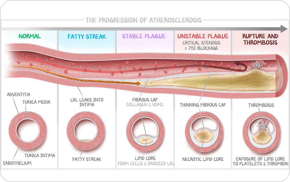 USMLE exam preparation — medical illustration